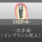 STEP-4 手術 インプラント埋入