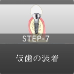 STEP-7 仮歯の装着